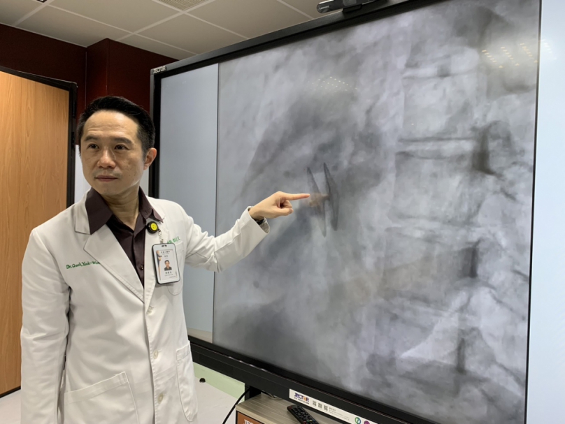 「卵圓孔」作祟！年僅20歲女大生突發性右側肢體無力、口齒不清