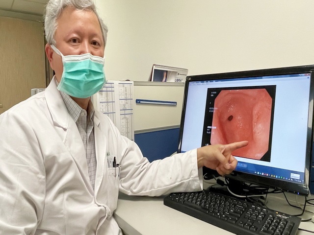 護理師胃悶痛竟罹「最凶險胃癌」 微創腹腔鏡手術切除病灶抗病魔