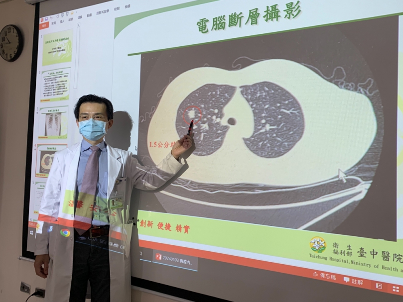 確診後久咳不癒以為「長新冠」　醫檢查竟是肺癌