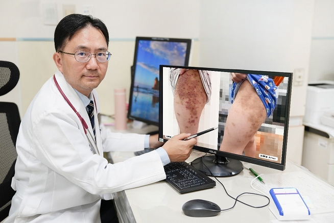 異位性皮膚炎新療法生物製劑助孩童擺脫長期紅疹與搔癢