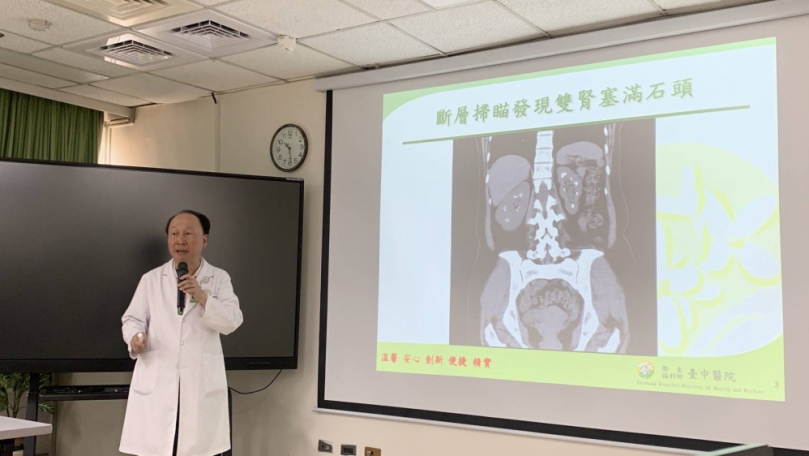 她2年5度腎結石  醫揪雙腎像「滿天星」原因竟是副甲狀腺亢進