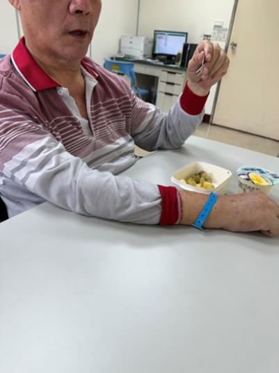 多元治療助腦中風患者脫離鼻胃管  重獲品嚐美食的喜悅