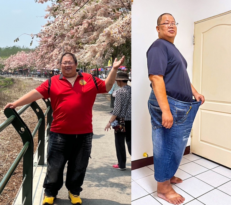 不只減重，更健康！43歲男子術後三個月甩36公斤 百天百例！中醫大附醫雨果機器手臂助重度肥胖者找回自信