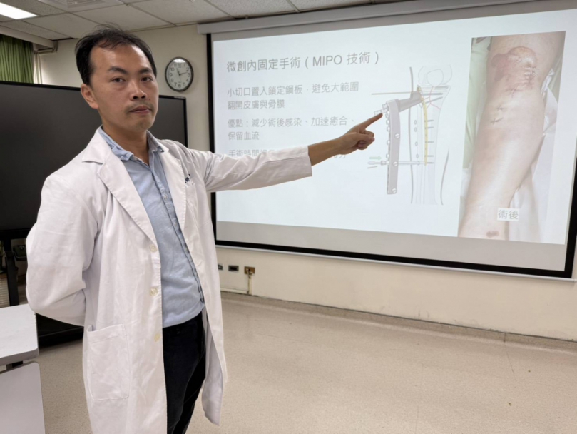 相約百貨公司刷刷樂  血拼姐車禍斷腿靠這治療讓她繼續樂享購