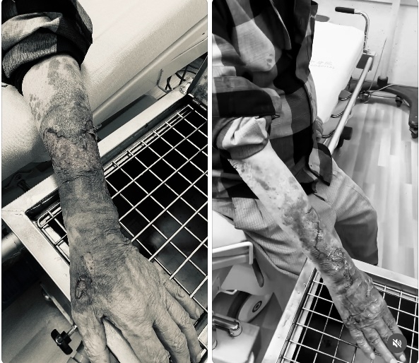 老翁被陳姓男子毆打成傷   警傳喚陳男到案訊後送辦