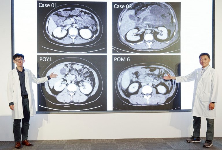 中國醫藥大學附設醫院導入多專科整合治療　提升壞死性胰臟炎重症照護成效