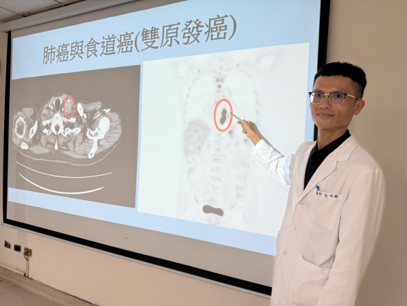 68歲台商驚罹雙癌 醫:肺癌追蹤應加做胃鏡