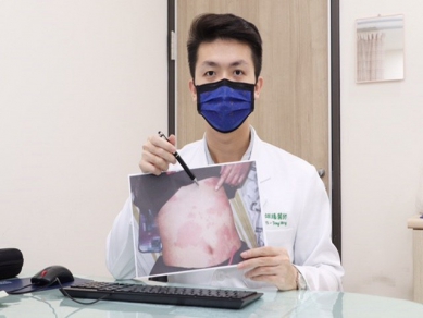 全身皮疹大發作  竟然是甲狀腺有問題