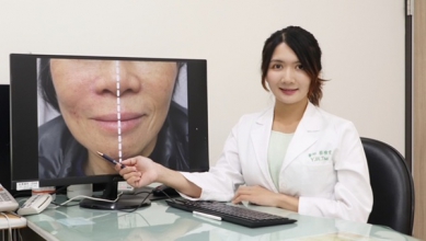 中年女臉部皺紋顯疲態    皮膚科醫師教你破解歲月痕跡