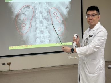 婦人半年三度腎結石就醫 醫師：恐與「雷氏斑」及生活習慣有關