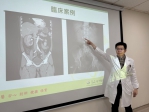 男三度腎結石 以「軟」擊碎石成功
