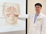 頭痛三個月吃藥沒效 原是鼻竇炎惹禍