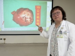 健檢驚見15公分巨大腫瘤　胸腔鏡手術發現竟是畸胎瘤